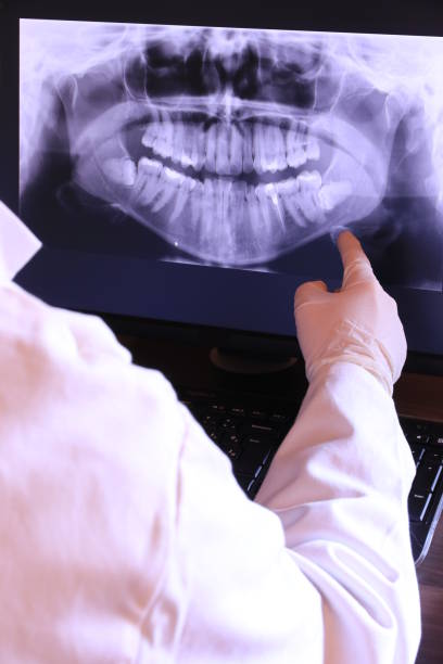 Best Broken or Cracked Tooth Emergency Dentist in Summit, WA