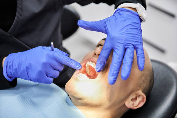 Best Emergency Dentist for Knocked-Out Tooth in Summit, WA
